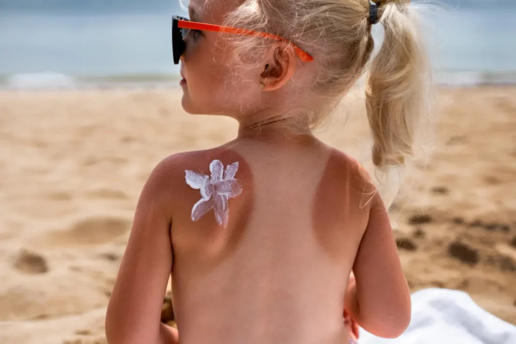 protector solar niños