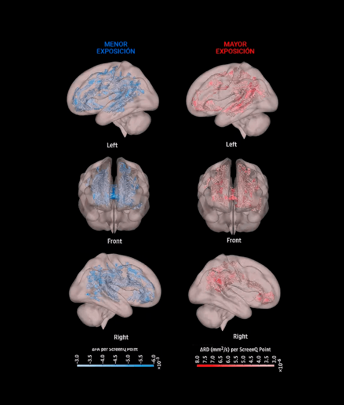 deterioro del cerebro por el uso excesivo de pantallas